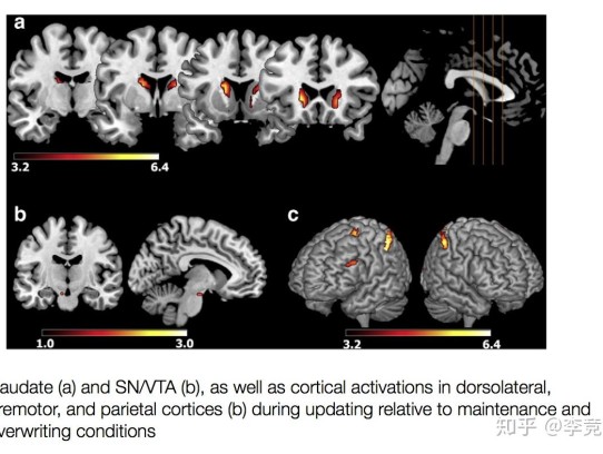 FMRi vs PET: Unraveling the Neuroscience of Brain Function Through Advanced Imaging Techniques